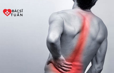 Các nguyên nhân, triệu chứng và cách phòng ngừa bệnh gai cột sống